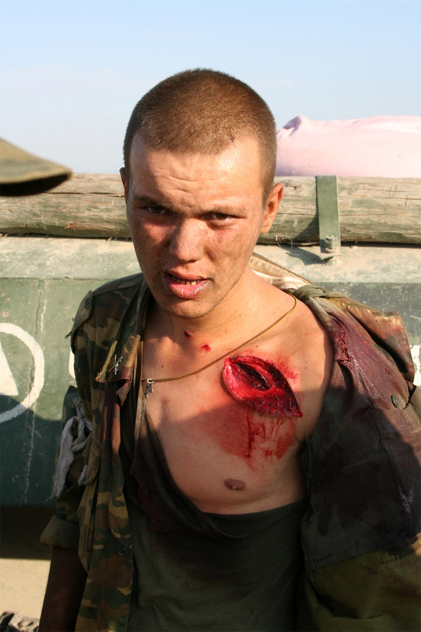 Wounded Russian soldier 